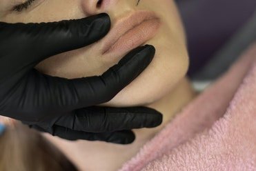 dermal filler injection ogden 2 orig