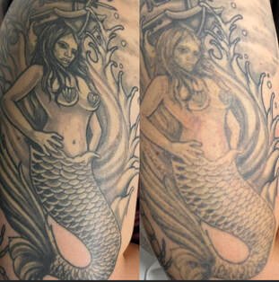 Professional tattoo removal Pleasant View UT